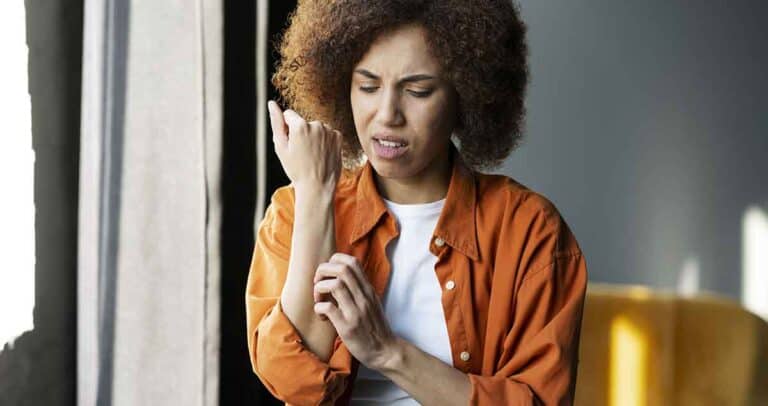 Multi-ethnic woman scratches her reddened hand due to itching. Allergy symptom, healthcare concept. Itchy skin can be caused by dermatitis, eczema, dry skin, burns, food - drug allergies, insect bites
