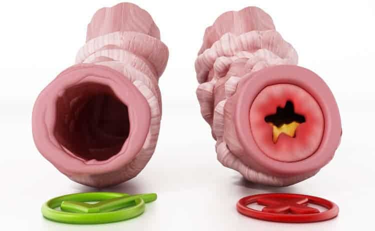 Illustration showing a comparison between a healthy and an unhealthy airway. The healthy airway is open, while the unhealthy one is constricted with a narrowed passage. A green check mark is next to the healthy airway, and a red cross is next to the unhealthy one.