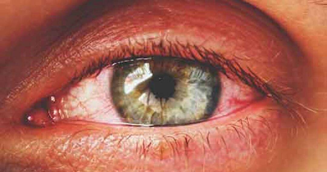 Close-up of a human eye with light green and brown hues. The eye is open wide, highlighting the details of the iris and eyelashes. The surrounding skin is lightly textured.